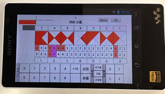 check3 歯周ポケットの測定